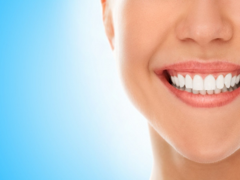 ניתוח שיני בינה - כל מה שצריך לדעת